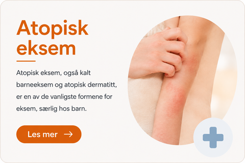 Atopisk eksem